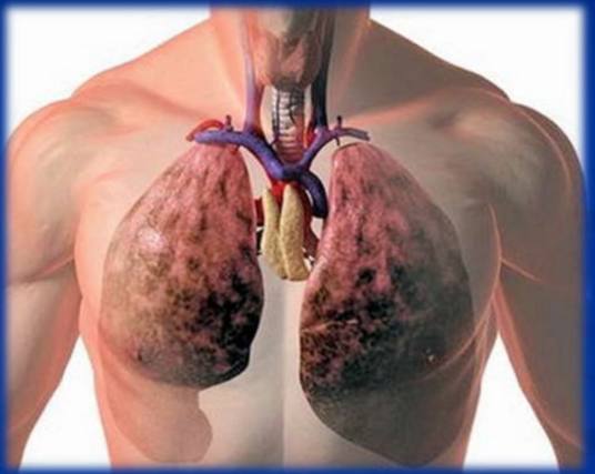 Ожоги верхних дыхательных путей в боевых условиях: признаки и последствия