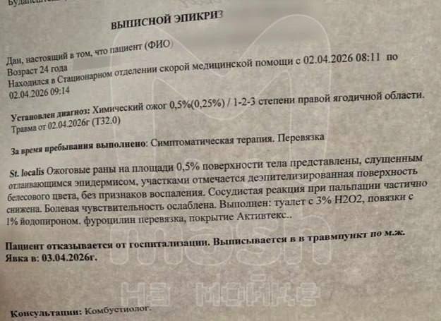 Петербурженка получила ожог в автобусе от неизвестного вещества