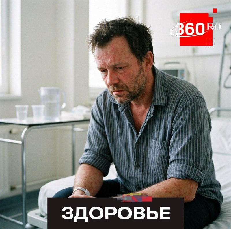В Пенсильвании впервые за 35 лет зафиксирована смерть от кори