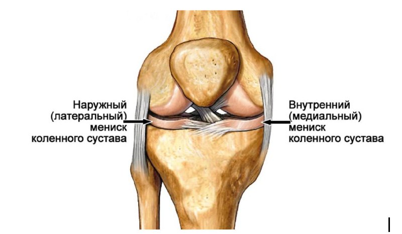 Разрыв латерального мениска: последствия и симптомы