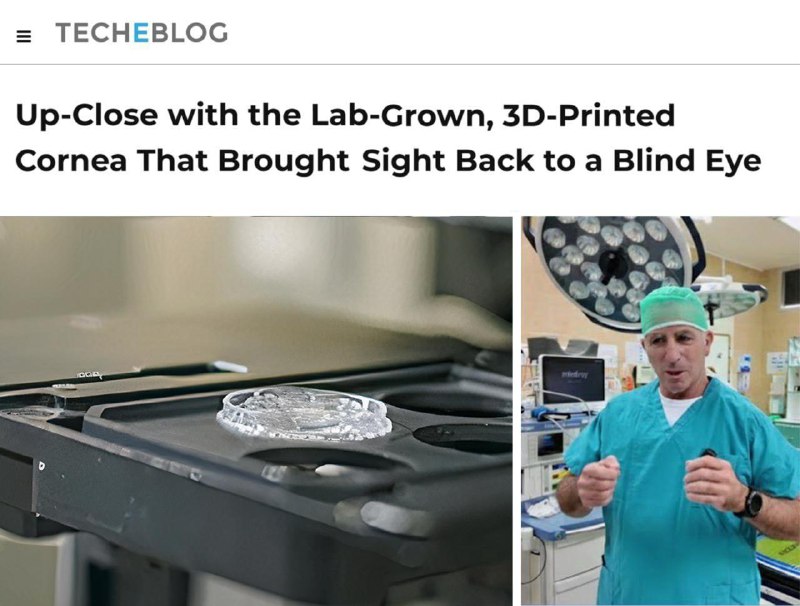 Врачам удалось вернуть зрение с помощью 3D-печатной роговицы глаза