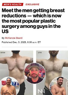 Уменьшение груди - тренд среди мужчин в США